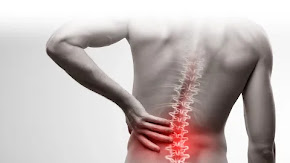 Physiotherapy Treatment for Back Pain in Jhansi
